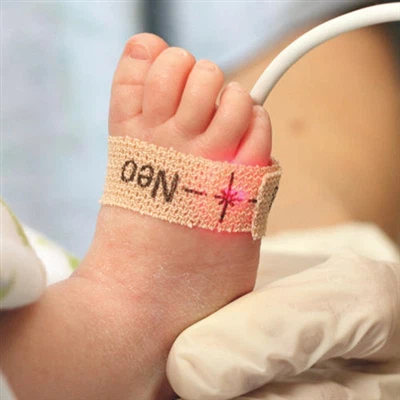 Sinais instáveis ​​de SpO2 na sala de cirurgia? A atualização do material da ...